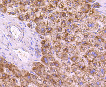 SGK1 Recombinant Rabbit Monoclonal Antibody