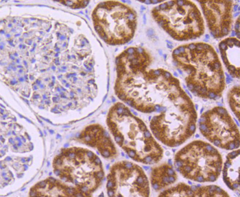 SGK1 Recombinant Rabbit Monoclonal Antibody
