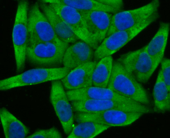 Wnt2b Recombinant Rabbit Monoclonal Antibody