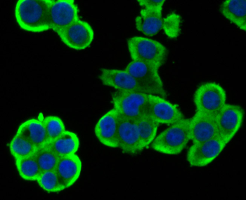 Wnt2b Recombinant Rabbit Monoclonal Antibody