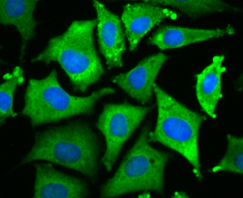 Wnt2b Recombinant Rabbit Monoclonal Antibody