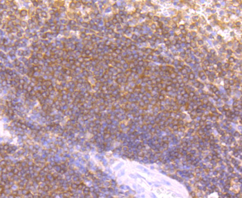 LYVE1 Recombinant Rabbit Monoclonal Antibody