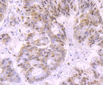 DNA Ligase IV Recombinant Rabbit Monoclonal Antibody