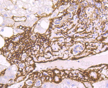 Alpha smooth muscle Actin Recombinant Rabbit Monoclonal Antibody