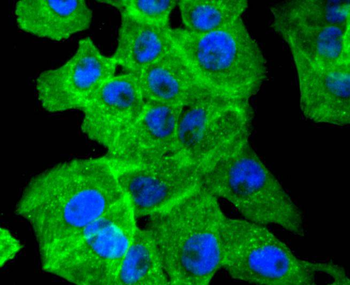 Alpha smooth muscle Actin Recombinant Rabbit Monoclonal Antibody