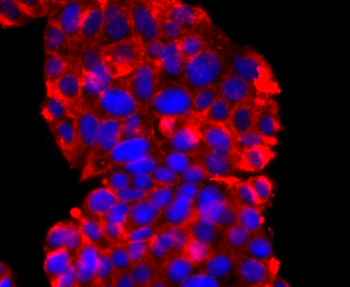 Synaptophysin Recombinant Rabbit Monoclonal Antibody