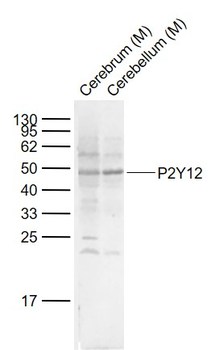 P2Y12 Rabbit Polyclonal Antibody