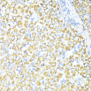 SQSTM1/p62 Rabbit Polyclonal Antibody