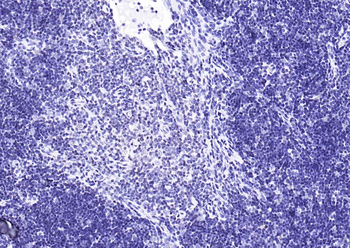 YY1 Recombinant Rabbit Monoclonal Antibody (Nuclear Loading Control)