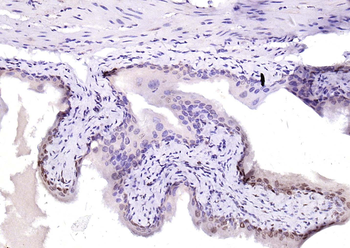 YY1 Recombinant Rabbit Monoclonal Antibody (Nuclear Loading Control)