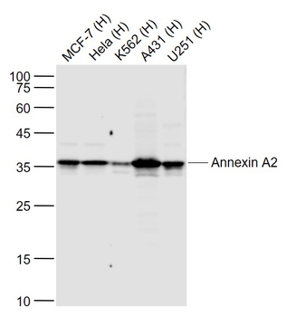 Annexin A2 Recombinant Rabbit Monoclonal Antibody