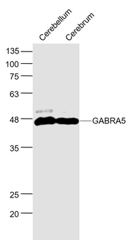 GABRA5 Rabbit Polyclonal Antibody