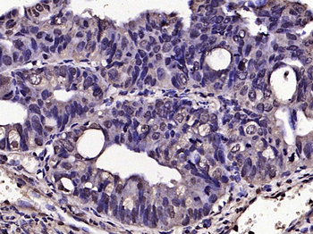 Phospho-SNAIL + SLUG (Ser246) Rabbit Polyclonal Antibody