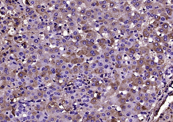Transferrin Mouse Monoclonal Antibody
