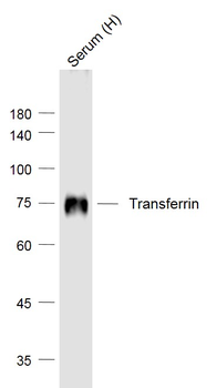 Transferrin Mouse Monoclonal Antibody
