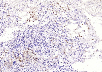 Phospho-JNK1/2/3 (T183+T183+T221) Recombinant Rabbit Monoclonal Antibody