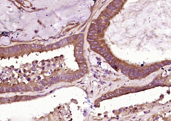 Transferrin Mouse Monoclonal Antibody (Serum Loading Control)
