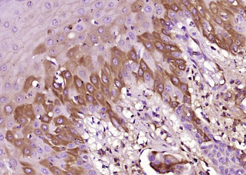 Transferrin Mouse Monoclonal Antibody (Serum Loading Control)