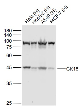 CK18 Mouse Monoclonal Antibody