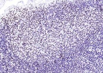 Phospho-SIRT1 (Ser47) Recombinant Rabbit Monoclonal Antibody