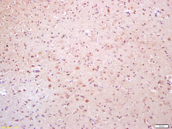 Phospho-TAK1 (Thr184) Rabbit Polyclonal Antibody