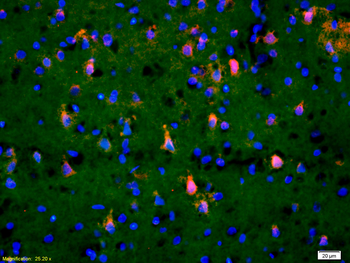 Phospho-TAK1 (Thr184 + Thr187) Rabbit Polyclonal Antibody