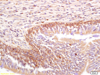 Phospho-Talin (Ser425) Rabbit Polyclonal Antibody