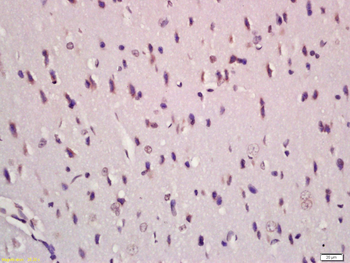 TGF Beta 1+2+3 Rabbit Polyclonal Antibody