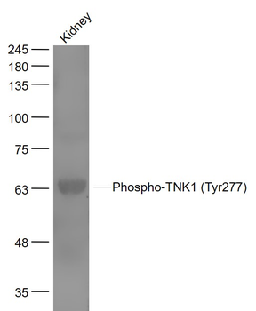 Phospho-TNK1 (Tyr277) Rabbit Polyclonal Antibody