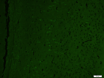 Alpha Dystroglycan Rabbit Polyclonal Antibody (FITC)