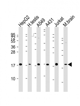 EEF1E1 Mouse Monoclonal Antibody
