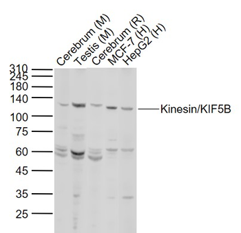 KIF5B Rabbit Polyclonal Antibody