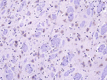 KIF5B Rabbit Polyclonal Antibody