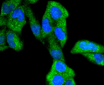 Phospho-GSK3 Alpha + Beta (Tyr279+Tyr216) Recombinant Rabbit Monoclonal Antibody