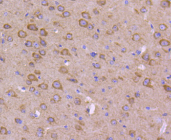 Phospho-GSK3 Alpha + Beta (Tyr279+Tyr216) Recombinant Rabbit Monoclonal Antibody