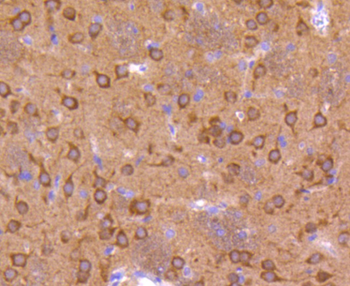 Phospho-GSK3 Alpha + Beta (Tyr279+Tyr216) Recombinant Rabbit Monoclonal Antibody