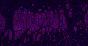 Donkey Anti-Rabbit IgG H&L, Cy5 conjugated