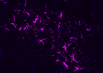 GFAP Rabbit Polyclonal Antibody (Cy5)