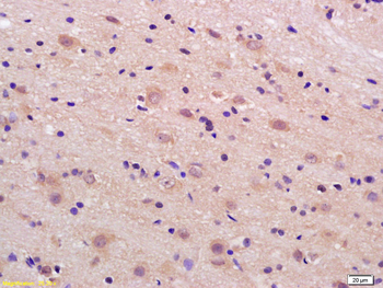 Phospho-LRP1 (Ser4523) Rabbit Polyclonal Antibody
