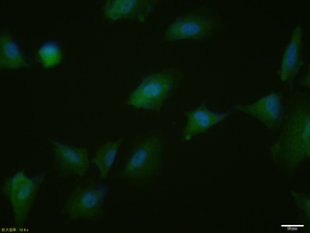 Phospho-PPAR Gamma (Ser112) Rabbit Polyclonal Antibody