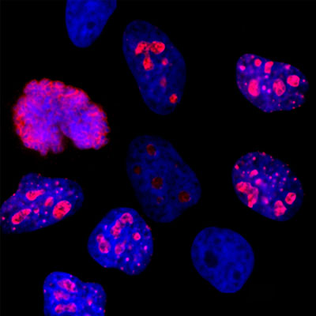 Ki-67 Antibody