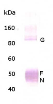 Respiratory Syncytial Virus Antibody