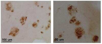 CLAC-P (NC3 region) Antibody
