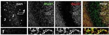 SHANK1a Antibody