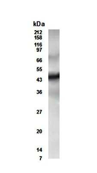 ETR3 (CUGBP2) Antibody