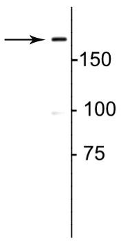 Collagen 1, alpha 1 propeptide Antibody