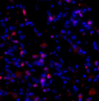 Collagen 1, alpha 1 propeptide Antibody