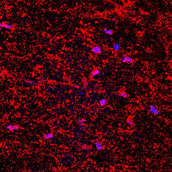 Collagen 1, alpha 1 telopeptide Antibody