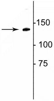 Collagen 1, alpha 1 telopeptide Antibody