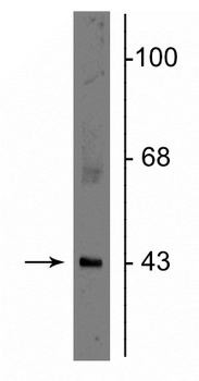 Connexin 43 Antibody